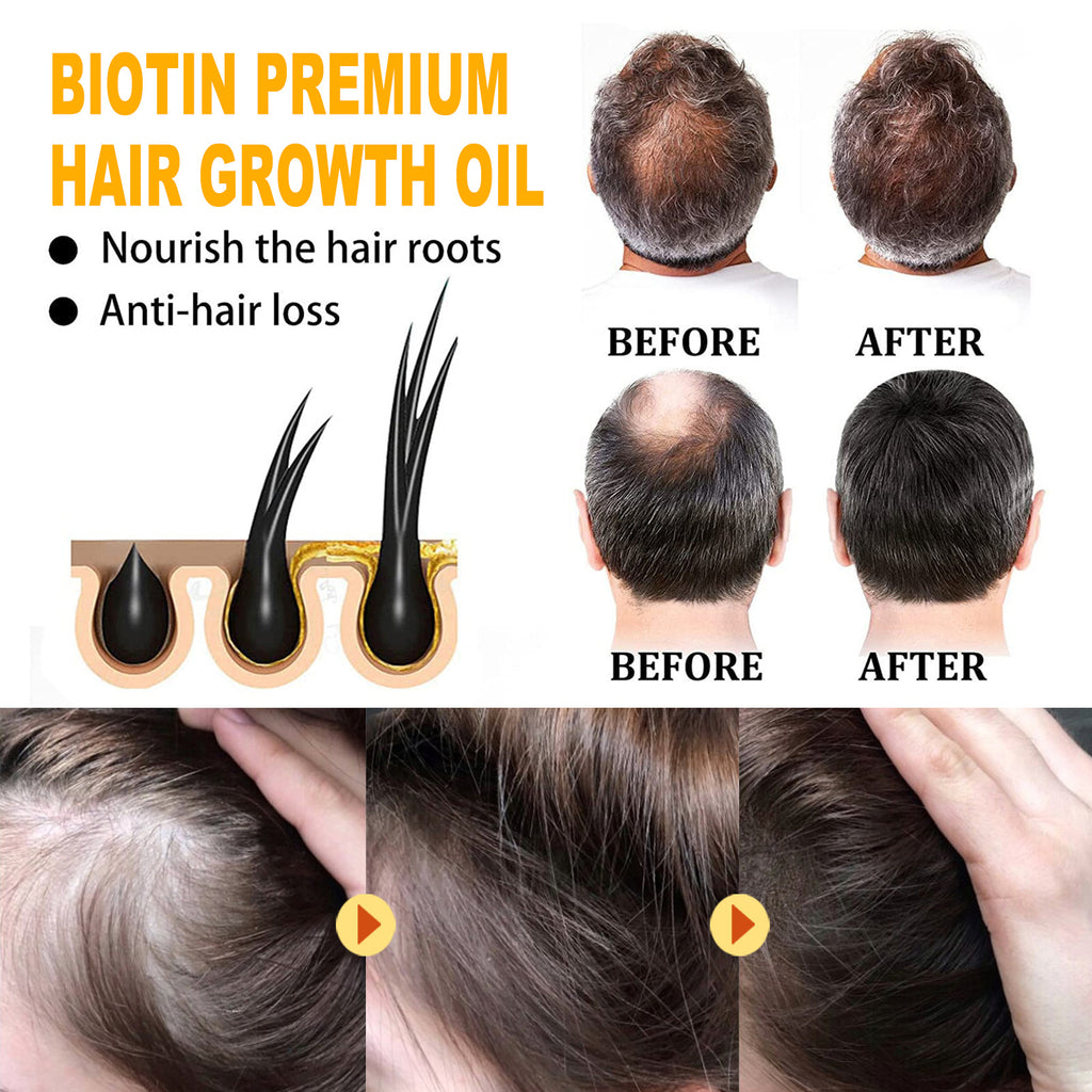 Biotin Hair Growth Oil – EELHOE