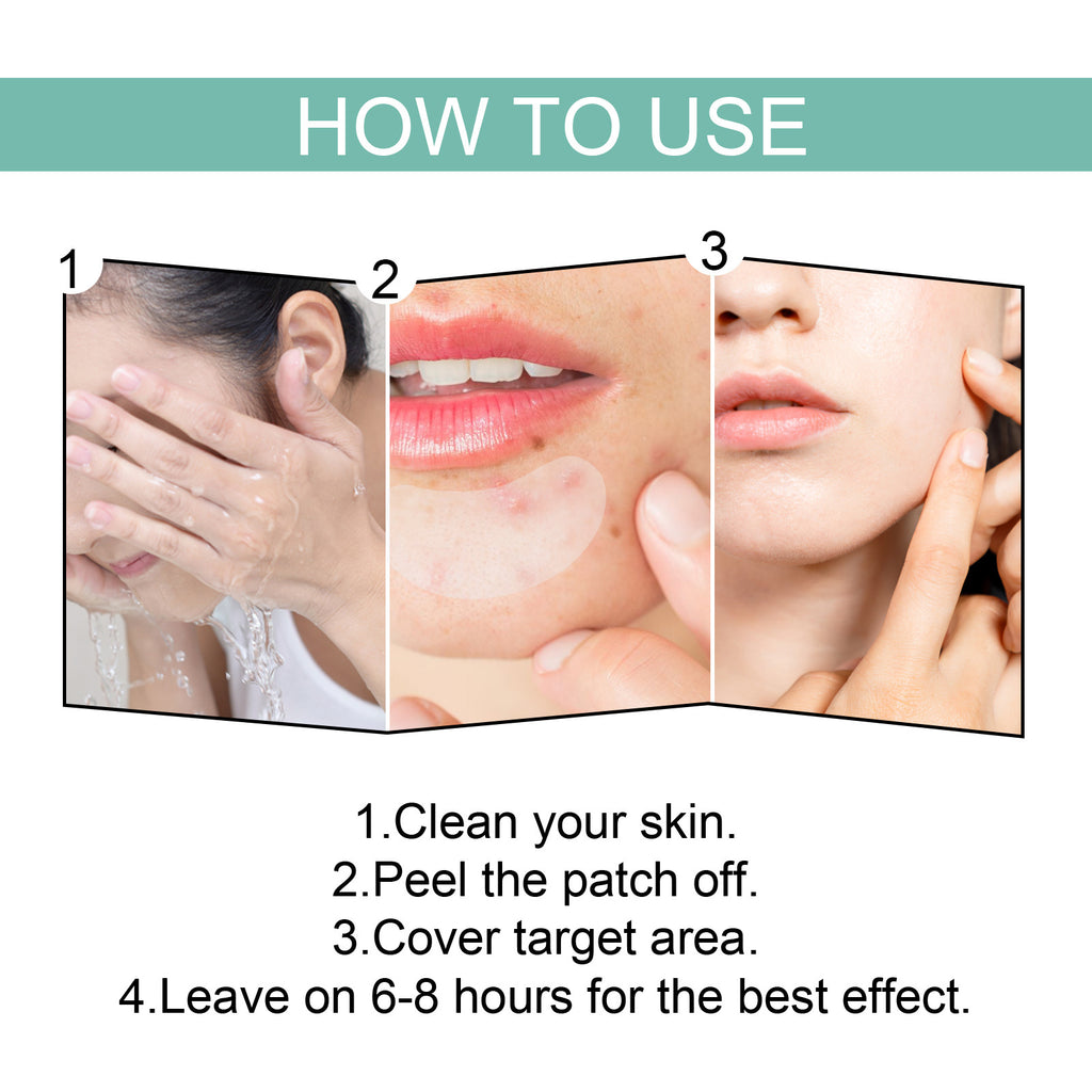 EELHOE Acne Healing Patch